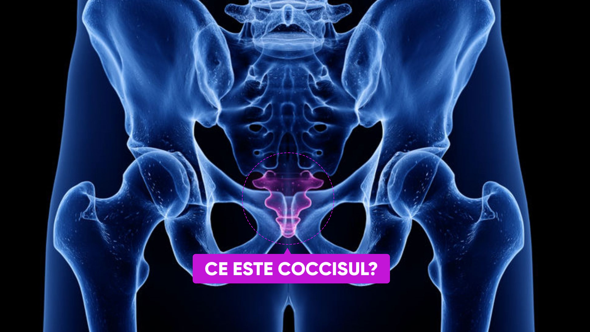 coccisul