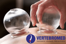 aplicarea ventuzelor partea 1