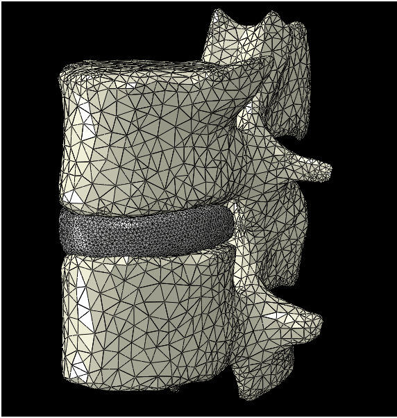 Coloana vertebrala
