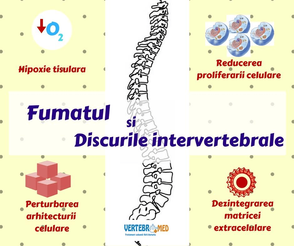discurile intervertebrale